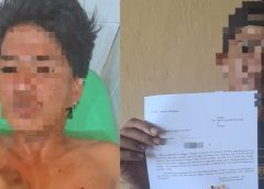 Korban Ditikam tanpa Sebab yang Jelas, Pelaku Diburu Polisi